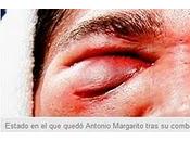 Nota ULTIMA HORA sobre anterior artículo