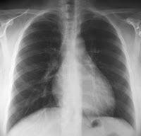 Mamá, quiero ser neumóloga