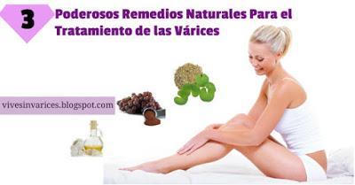 Remedios Naturales Para las Varices Tratamiento para las Varices