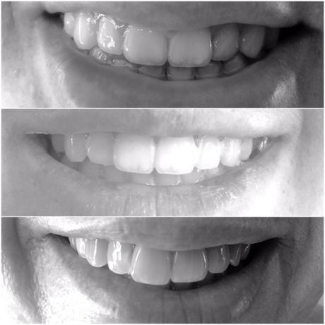 Micro Palabras (4): PÉRDIDAS HALLADAS