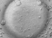 Tipo indicaciones diferentes Técnicas Reproducción Asistida.