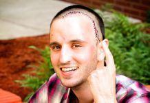 ¿Podríamos heredar ansiedad y depresión de nuestros padres?