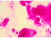 veces, estar alerta sirve nada