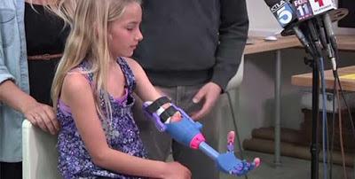 VIDEO: Niña Recibe Prótesis de su mano en 3D