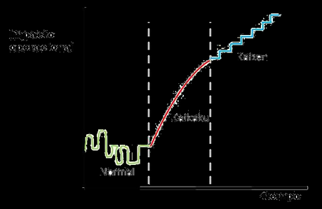 Cambio radical operacional: Kaikaku