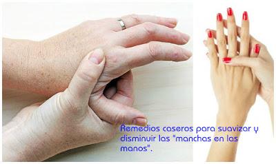 Remedios caseros para suavizar y eliminar las manchas de las manos