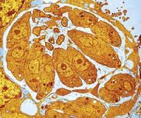 La inquietante bacteria que manipula la voluntad humana