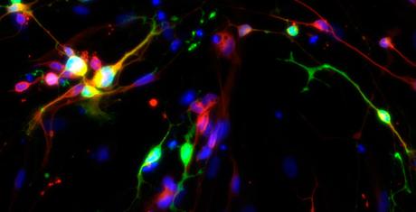 Científicos logran crear neuronas productoras de serotonina humana en un laboratorio