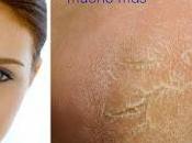 Cómo suavizar piel- brazos-cutis- talones codos