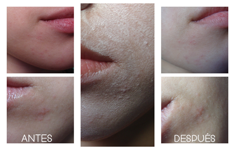 Review | Tomatox Maggic Massage Pack - TONYMOLY