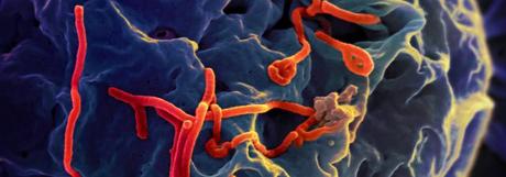 El biobanco del ébola