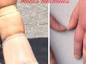 Tips para evitar hinchazón pies manos verano