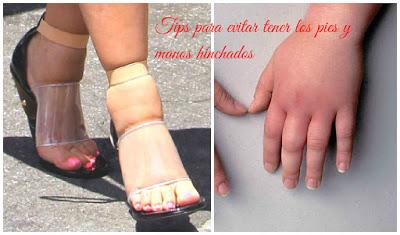 Tips para evitar la hinchazón de pies y manos en verano