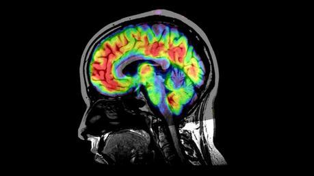 ¿Cómo funciona el efecto placebo? ¿Cómo funciona el efecto placebo?