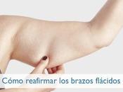 Cómo reducir flacidez brazos