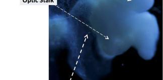 ¿Las selfies están arruinando tu vida?