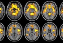 El primer cerebro humano creado en laboratorio