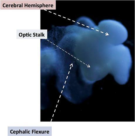 El primer cerebro humano creado en laboratorio