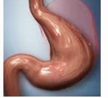 tratamiento obesidad almería con el Método POSE