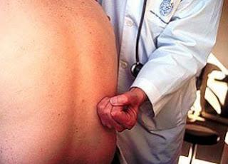 ¿ Qué es la puño percusión renal?