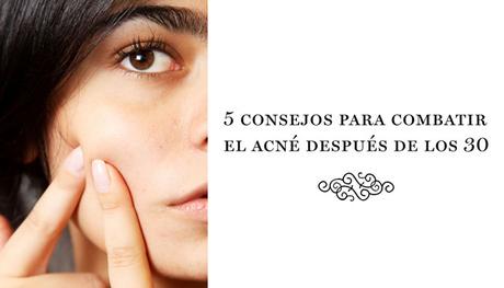 5 consejos para combatir el acné después de los 30