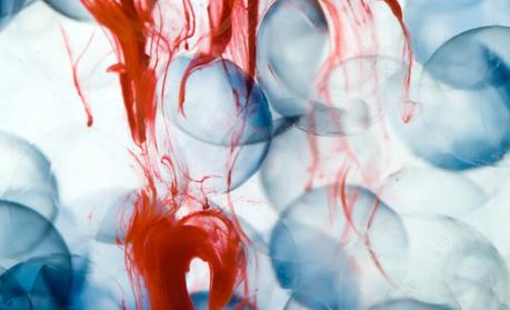 Priones, las proteínas asesinas