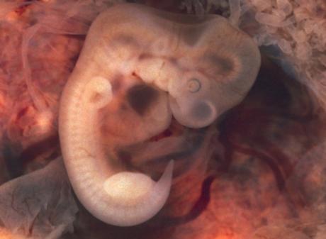 Condición jurídica del embrión humano en Europa Situación legal de un embrión humano