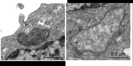 La vitamina B3 mejora la función lisosomal y la inflamación en enfermedades mitocondriales