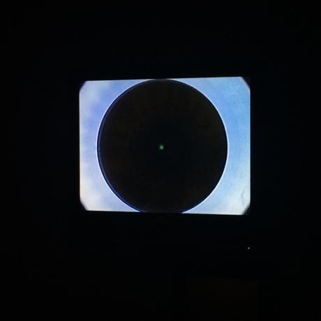 #RelexSmileVlc: EL DÍA DE LA OPERACION DE MIOPIA! #RelexSmileVlc: EL DÍA DE LA OPERACION DE MIOPIA!