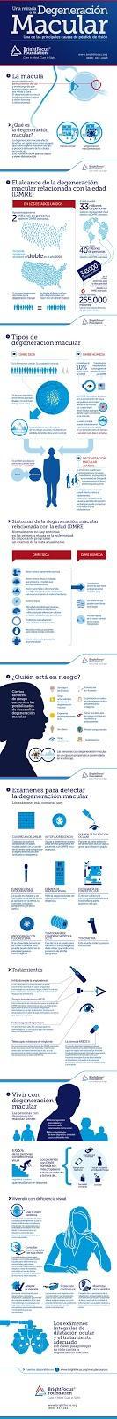 Degeneración macular #salud #enfermedad #infografía