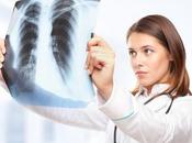 Prevención diagnóstico cáncer pulmón