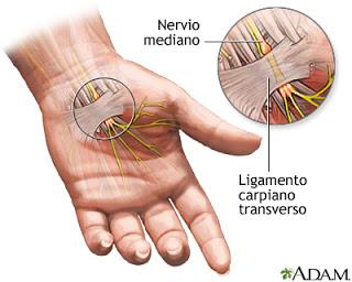 Adicción a conversar en linea: Sindrome del Túnel Carpiano