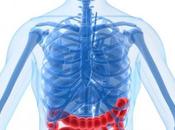 Datos sobre Síndrome Intestino Irritable