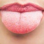 Lengua blanca, mal aliento