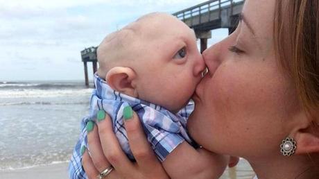 ¡CONMUEVE AL MUNDO! JAXON, EL BEBÉ QUE NACIÓ SIN PARTE DEL CRÁNEO Y CEREBRO (+VIDEO)