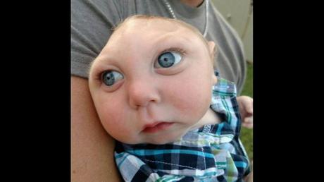 ¡CONMUEVE AL MUNDO! JAXON, EL BEBÉ QUE NACIÓ SIN PARTE DEL CRÁNEO Y CEREBRO (+VIDEO)