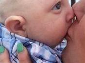 ¡conmueve mundo! jaxon, bebé nació parte cráneo cerebro (+video)