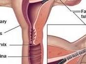Comienzan aplicarse restricciones anticonceptivo Essure