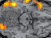 Investigan regiones cerebrales encargadas lectura conexión lenguaje hablado reconocimiento facial