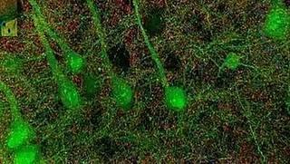 Las imágenes más impactantes del cerebro