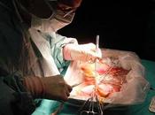 Posibles objeciones bioéticas trasplante órganos