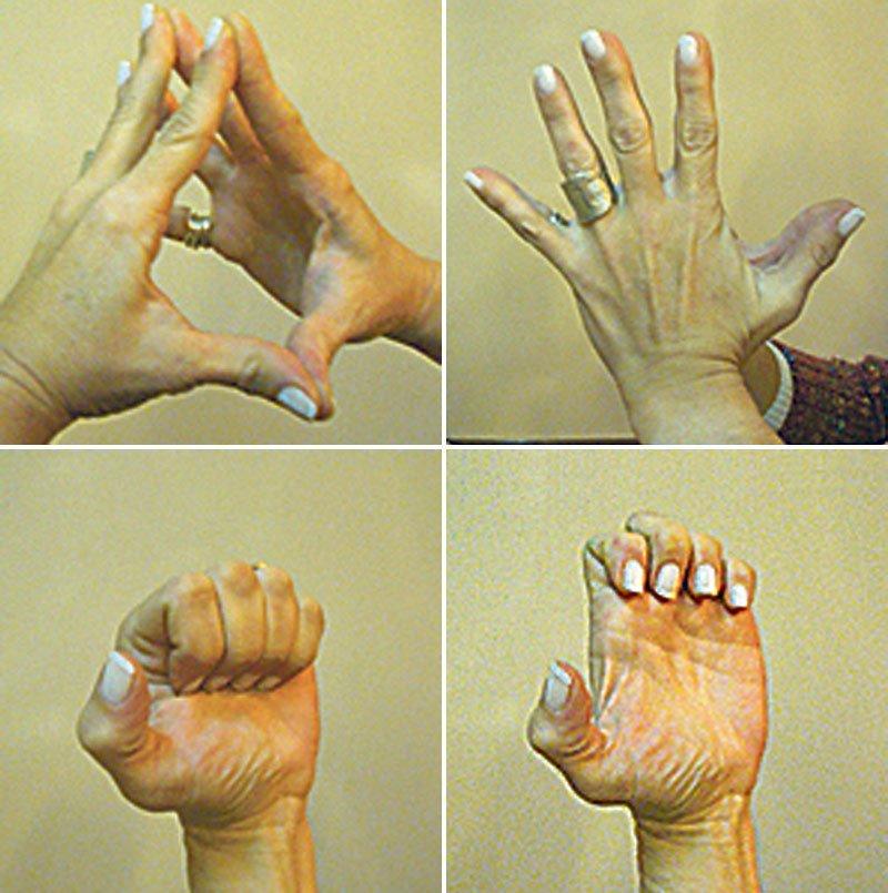 Ejercicios para evitar el dolor de muñeca