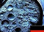 Médicos curan leucemia células estaminales cordón umbilical