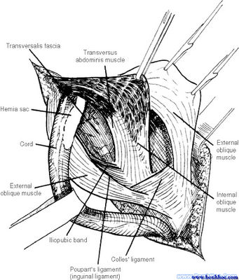 Curso Hernias