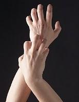 Colestasis y embarazo