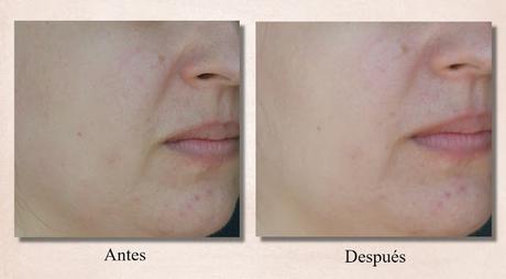 “Youthmud Tinglexfoliate Treatment” de GLAMGLOW – la mascarilla de las estrellas de Hollywood