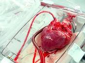¿Cuántos trasplantes corazón puede recibir misma persona habiendo lista espera?