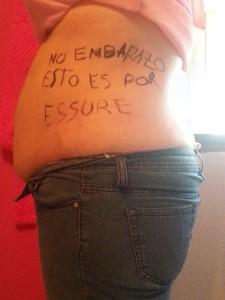 Essure embarazo