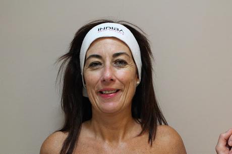 TRATAMIENTO INDIBA EN MÁS SALUD MÁS BELLEZA