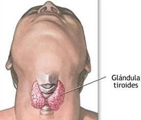 Tiroides, hipotiroidismo, hipertirodismo, bocio y cáncer,